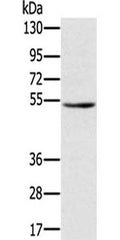 Gel: 8%SDS-PAGE, Lysate: 40 ug, Lane: A549 cells, Primary antibody: CSB-PA971239(TMPRSS2 Antibody) at dilution 1/350, Secondary antibody: Goat anti rabbit IgG at 1/8000 dilution, Exposure time: 2 minutes