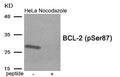 Western blot analysis of extracts from HeLa cells treated with Nocodazole using Phospho-BCL-2 (Ser87) antibody.The lane on the right is treated with the antigen-specific peptide.