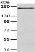 Gel: 6%SDS-PAGE,Lysate: 40 ug,,Primary antibody: CSB-PA972166(ERBB2 Antibody) at dilution 1/200 dilution,Secondary antibody: Goat anti rabbit IgG at 1/8000 dilution,Exposure time: 1 minute