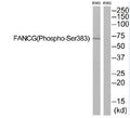 Western blot analysis of extracts from K562 cells, using FANCG (Phospho-Ser383) antibody. The lane on the right is treated with the synthesized peptide.