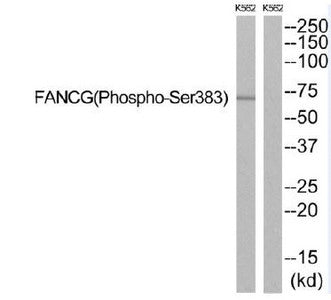 Western blot analysis of extracts from K562 cells, using FANCG (Phospho-Ser383) antibody. The lane on the right is treated with the synthesized peptide.