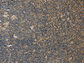 The image on the left is immunohistochemistry of paraffin-embedded Human tonsil tissue using CSB-PA972361(DDX19B Antibody) at dilution 1/20, on the right is treated with fusion protein. (Original magnification: ×200)
