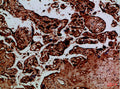 Immunohistochemical analysis of paraffin-embedded Human-placenta, antibody was diluted at 1:100