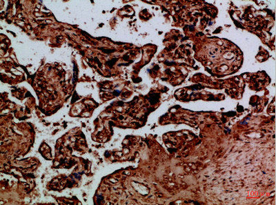 Immunohistochemical analysis of paraffin-embedded Human-placenta, antibody was diluted at 1:100