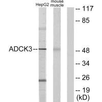 Western blot analysis of extracts from HepG2 cells and mouse muscle cells, using ADCK3 antibody.