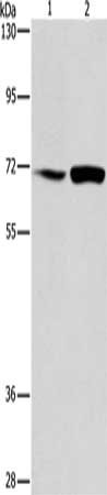 Gel: 8%SDS-PAGE, Lysate: 40 ug, Lane 1-2: A549 cells, hela cells, Primary antibody: CSB-PA973147(ACADVL Antibody) at dilution 1/200, Secondary antibody: Goat anti rabbit IgG at 1/8000 dilution, Exposure time: 30 seconds