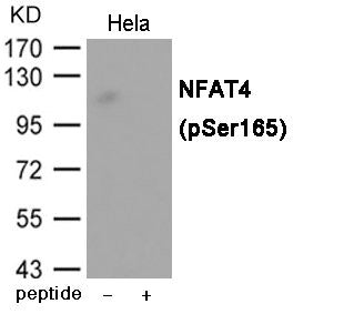 Western blot analysis of extracts from Hela cells using NFAT4 (Phospho-Ser165) Antibody.The lane on the right is treated with the antigen-specific peptide.