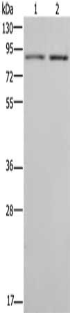 Gel: 8%SDS-PAGE, Lysate: 40 ug, Lane 1-2: Jurkat cells, 231 cells, Primary antibody: CSB-PA973311(MDM2 Antibody) at dilution 1/200, Secondary antibody: Goat anti rabbit IgG at 1/8000 dilution, Exposure time: 10 seconds
