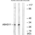 Western blot analysis of extracts from HUVEC cells and COLO cells, using ABHD11 antibody.