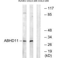 Western blot analysis of extracts from HUVEC cells and COLO cells, using ABHD11 antibody.