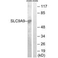 Western blot analysis of extracts from RAW264.7 cells, NIH/3T3 cells and A549 cells, using SLC9A9 antibody.