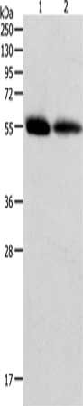 Gel: 10%SDS-PAGE, Lysate: 60 ug, Lane 1-2: Human colon tissue, Human ovarian cancer tissue, Primary antibody: CSB-PA974106(MMP11 Antibody) at dilution 1/600, Secondary antibody: Goat anti rabbit IgG at 1/8000 dilution, Exposure time: 20 seconds