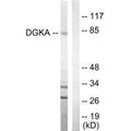 Western blot analysis of extracts from Jurkat cells, using DGKA antibody.