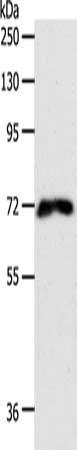 Gel: 8%SDS-PAGE, Lysate: 40 ug, Lane: 293T cells, Primary antibody: CSB-PA974307(FZD1 Antibody) at dilution 1/500, Secondary antibody: Goat anti rabbit IgG at 1/8000 dilution, Exposure time: 1 minute