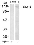 Western blot analysis of extracts from Hela cells using STAT2(Ab-690) Antibody and the same antibody preincubated with blocking peptide.