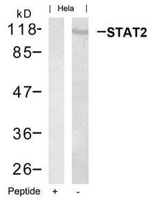 Western blot analysis of extracts from Hela cells using STAT2(Ab-690) Antibody and the same antibody preincubated with blocking peptide.