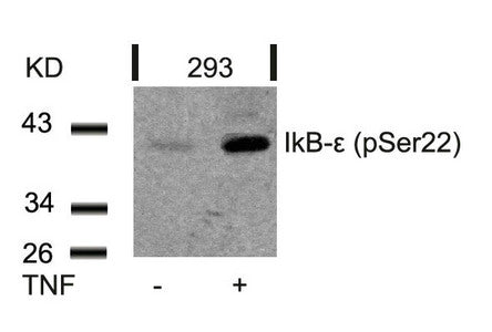 Western blot analysis of extracts from 293 cells untreated or treated with TNF using IkB-e(Phospho-Ser22) Antibody.