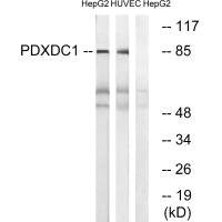 Western blot analysis of extracts from HepG2 cells and HUVEC cells, using PDXDC1 antibody.
