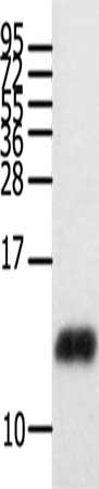 Gel: 12%SDS-PAGE, Lysate: 40 ug, Lane: Human brain glioma tissue, Primary antibody: CSB-PA975229(CCL28 Antibody) at dilution 1/450, Secondary antibody: Goat anti rabbit IgG at 1/8000 dilution, Exposure time: 1 minute