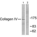Western blot analysis of extracts from HeLa cells, using Collagen IV antibody.