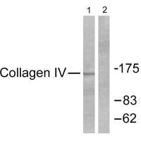 Western blot analysis of extracts from HeLa cells, using Collagen IV antibody.