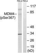 Western blot analysis of extracts from HeLa cells, treated with calyculinA (50ng/ml, 30mins), using MDM4 (Phospho-Ser367) antibody. The lane on the right is treated with the synthesized peptide.