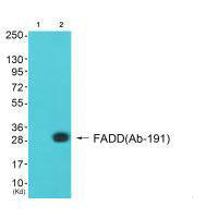 Western blot analysis of extracts from A549 cells (Lane 2), using FADD (Ab-191) antiobdy. The lane on the left is treated with synthesized peptide.