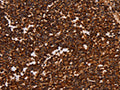 The image on the left is immunohistochemistry of paraffin-embedded Human tonsil tissue using CSB-PA976819(ALG11 Antibody) at dilution 1/40, on the right is treated with synthetic peptide. (Original magnification: ×200)