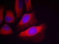 Immunofluorescence staining of methanol-fixed HeLa cells using IKK-beta; (Phospho-Tyr199) Antibody.