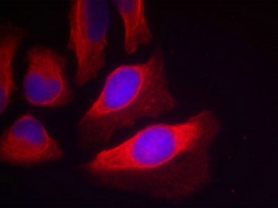 Immunofluorescence staining of methanol-fixed HeLa cells using IKK-beta; (Phospho-Tyr199) Antibody.