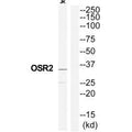 Western blot analysis of extracts from Jurkat cells, using OSR2 antibody.