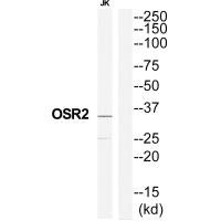 Western blot analysis of extracts from Jurkat cells, using OSR2 antibody.