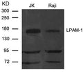 Western blot analysis of extract from JK and Raji cells using LPAM-1(Integrin a4, CD49d) Antibody