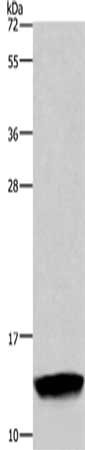 Gel: 10%SDS-PAGE,Lysate: 40 ug,,Primary antibody: CSB-PA978056(FABP2 Antibody) at dilution 1/350 dilution,Secondary antibody: Goat anti rabbit IgG at 1/8000 dilution,Exposure time: 2 minutes