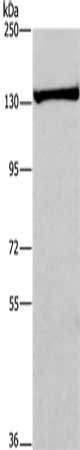 Gel: 6%SDS-PAGE, Lysate: 40 ug, Lane: Human prostate tissue, Primary antibody: CSB-PA978160(ADAMTS18 Antibody) at dilution 1/250, Secondary antibody: Goat anti rabbit IgG at 1/8000 dilution, Exposure time: 10 minutes