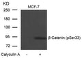 Western blot analysis of extracts from MCF-7 cells untreated or treated with Calyculin A using b-Catenin(Phospho-Ser33) Antibody.