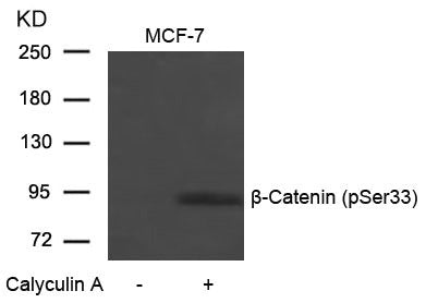 Western blot analysis of extracts from MCF-7 cells untreated or treated with Calyculin A using b-Catenin(Phospho-Ser33) Antibody.
