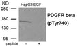 Western blot analysis of extracts from HepG2 cells treated with EGF using Phospho-PDGFR beta (Tyr740) antibody.The lane on the right is treated with the antigen-specific peptide.