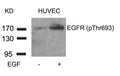 Western blot analysis of extracts from HUVEC cells untreated or treated with EGF using EGFR(Phospho-Thr693) Antibody.