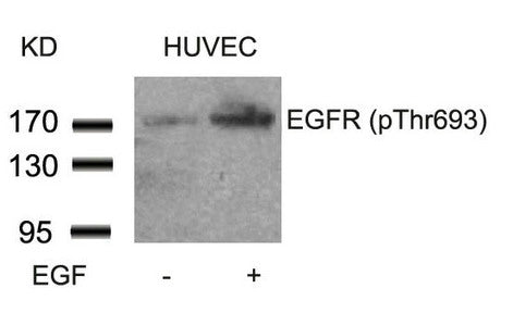Western blot analysis of extracts from HUVEC cells untreated or treated with EGF using EGFR(Phospho-Thr693) Antibody.