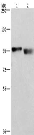 Gel: 6%SDS-PAGE, Lysate: 40 ug, Lane 1-2: A431 cells, lovo cells, Primary antibody: CSB-PA980052(KIAA1524 Antibody) at dilution 1/597, Secondary antibody: Goat anti rabbit IgG at 1/8000 dilution, Exposure time: 1 second
