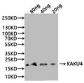 Western Blot
Positive WB detected in: recombinant protein
All lanes:KAKU4 Antibody at 1:1000
Secondary
Goat polyclonal to rabbit IgG at 1/20000 dilution
Predicted band size: 18.6 kDa
Observed band size: 19 kDa