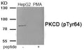 Western blot analysis of extracts from HepG2 cells treated with PMA using Phospho-PKCD (Tyr64) antibody.The lane on the right is treated with the antigen-specific peptide.