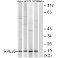 Western blot analysis of extracts from HeLa cells, Jurkat cells, COLO cells and 293 cells, using RPL35 antibody.