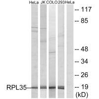 Western blot analysis of extracts from HeLa cells, Jurkat cells, COLO cells and 293 cells, using RPL35 antibody.