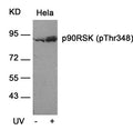 Western blot analysis of extracts from Hela cells untreated or treated with UV using p90RSK(Phospho-Thr348) Antibody.