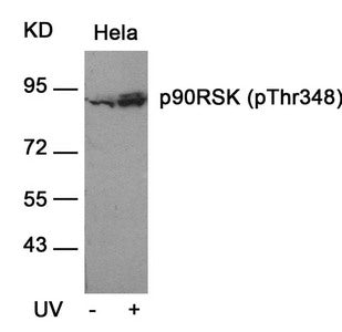 Western blot analysis of extracts from Hela cells untreated or treated with UV using p90RSK(Phospho-Thr348) Antibody.