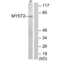 Western blot analysis of extracts from Jurkat cells, using MYST2 antibody.