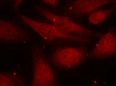 Immunofluorescence staining of methanol-fixed HeLa cells using c-Abl (phospho-Tyr412) antibody.