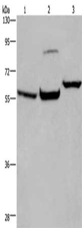 Gel: 8%SDS-PAGE, Lysate: 40 ug, Lane 1-3: Mouse brain tissue, 231 cells, Hela cells, Primary antibody: CSB-PA980849(ESR1 Antibody) at dilution 1/200, Secondary antibody: Goat anti rabbit IgG at 1/8000 dilution, Exposure time: 1 minute